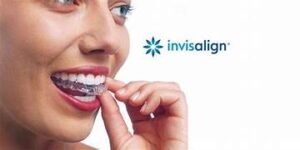 invisalign-provider-in-pala